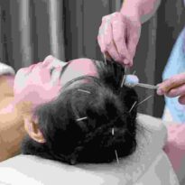 Hair Transplant Treatment Hair Transplant Treatment